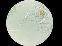 Sclerotinia
