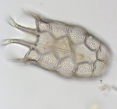 Keratella serrulata