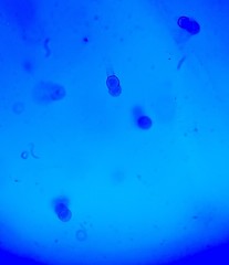 Glomeromycetes