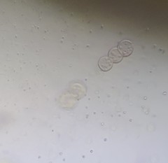 Glomeromycetes