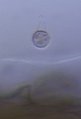 Glomeromycetes