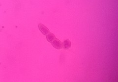 Glomeromycetes