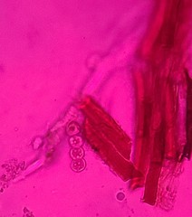 Glomeromycetes