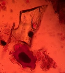 Glomeromycetes