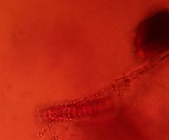 Glomeromycetes