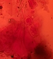 Glomeromycetes