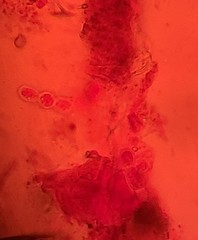 Glomeromycetes