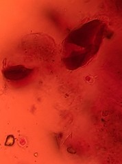 Glomeromycetes