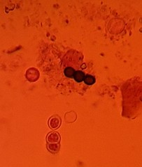 Glomeromycetes