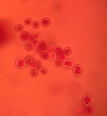 Glomeromycetes