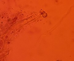 Glomeromycetes