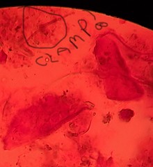 Glomeromycetes