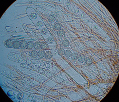 Scutellinia trechispora
