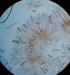 Scutellinia trechispora