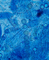 Scutellinia trechispora
