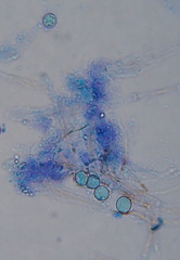 Scutellinia trechispora