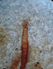Scutellinia trechispora