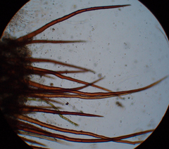 Scutellinia trechispora