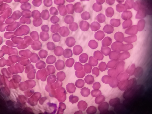 Representative image of Piroplasmida