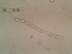 Octospora excipulata