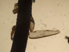 Sphagnum subsecundum