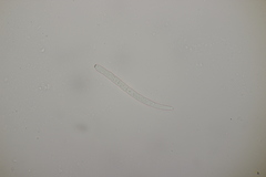 Cercospora mercurialis