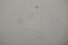 Cercospora mercurialis