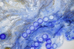 Scutellinia trechispora
