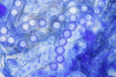 Scutellinia trechispora