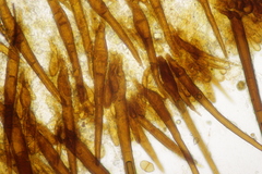 Scutellinia trechispora