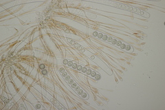 Scutellinia trechispora