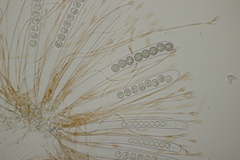 Scutellinia trechispora