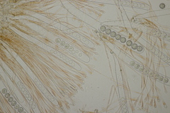 Scutellinia trechispora