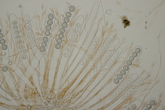Scutellinia trechispora