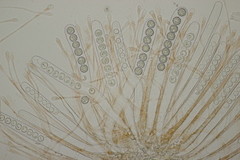 Scutellinia trechispora