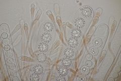 Scutellinia trechispora