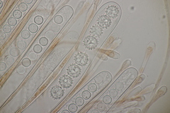 Scutellinia trechispora