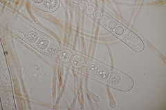 Scutellinia trechispora
