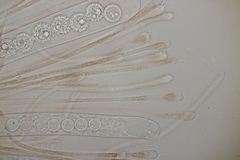 Scutellinia trechispora