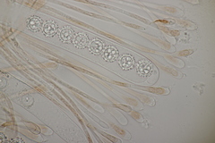 Scutellinia trechispora