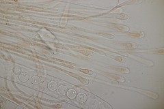 Scutellinia trechispora