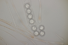 Scutellinia trechispora