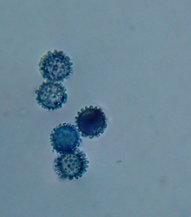 Scutellinia trechispora