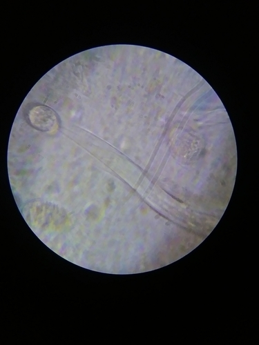 Nematoda