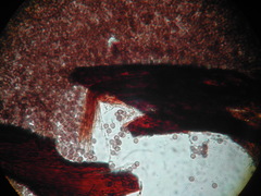 Comatricha reticulospora