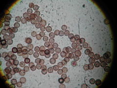 Comatricha reticulospora