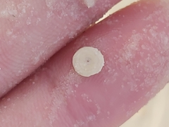Marginopora vertebralis