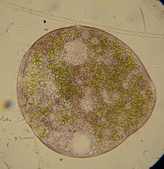 Stentor amethystinus