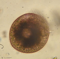 Stentor amethystinus