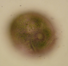 Stentor amethystinus